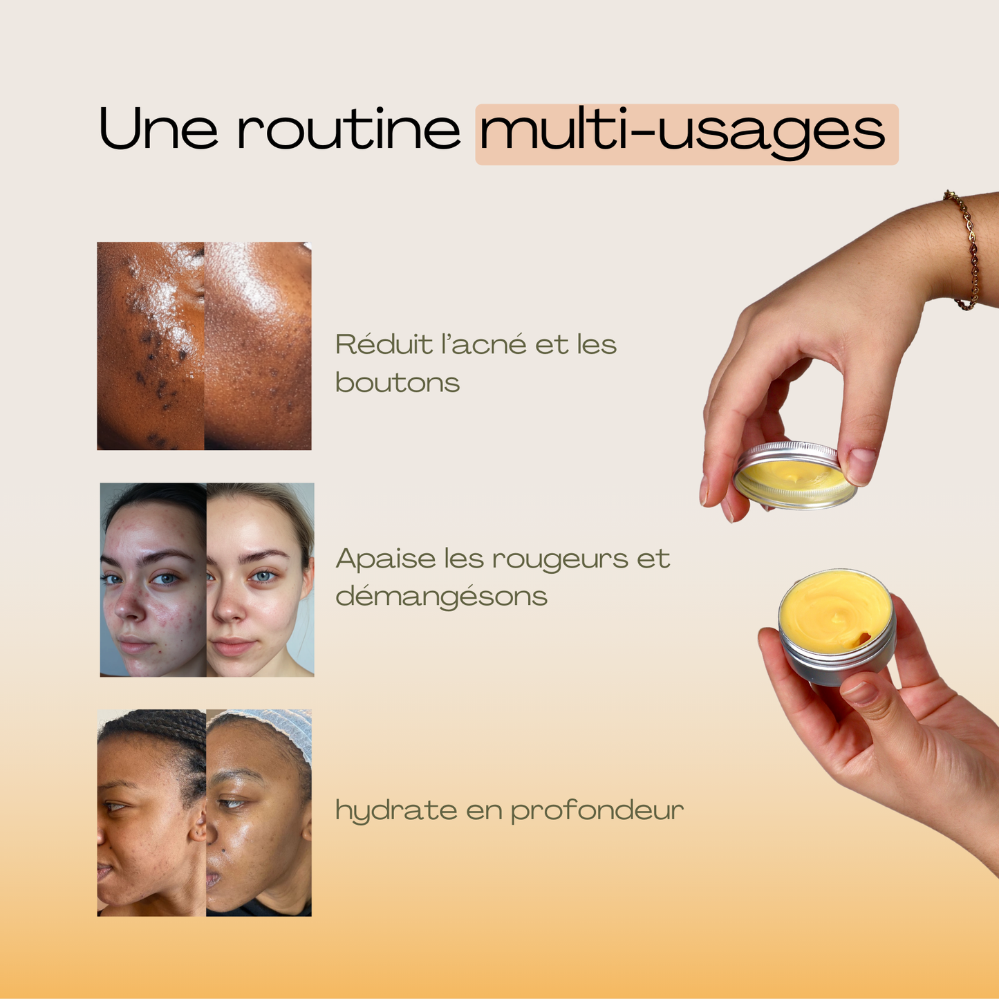 Baume de nuit anti-acné