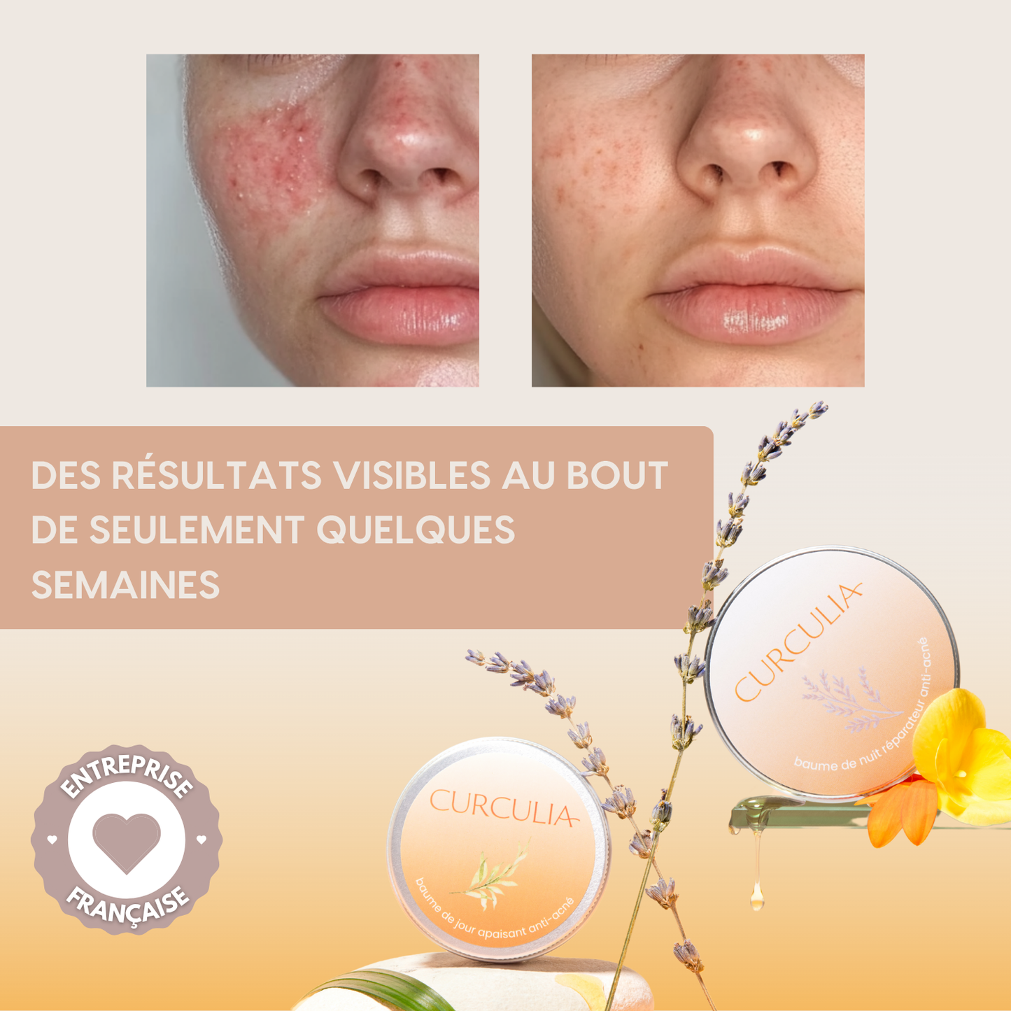 Baumes Apaisants Anti-Acné