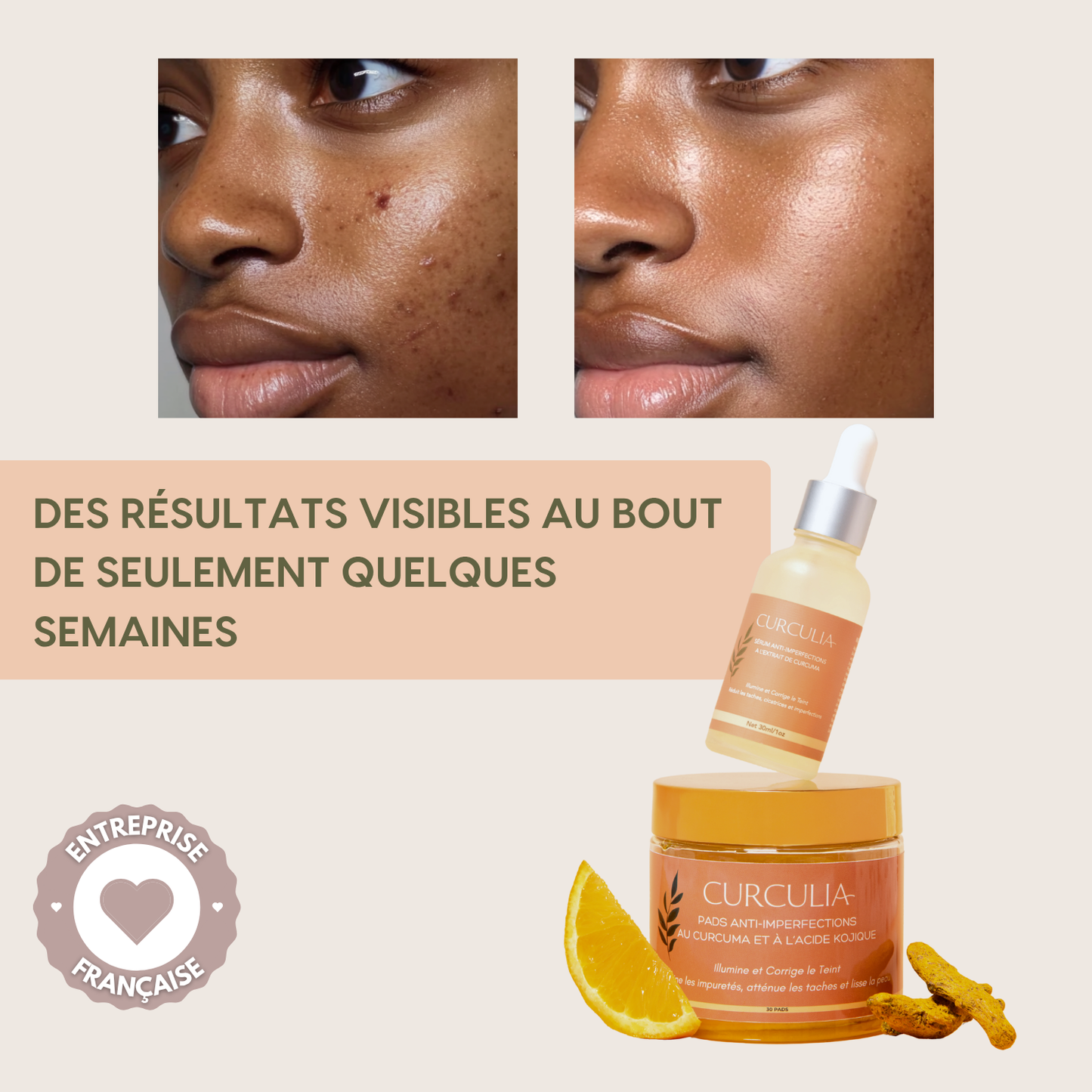 Routine Anti-Imperfections 4 en 1