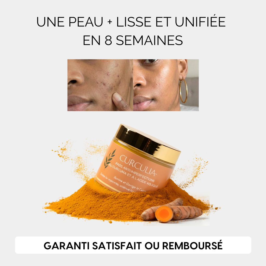 Routine Anti-Imperfections