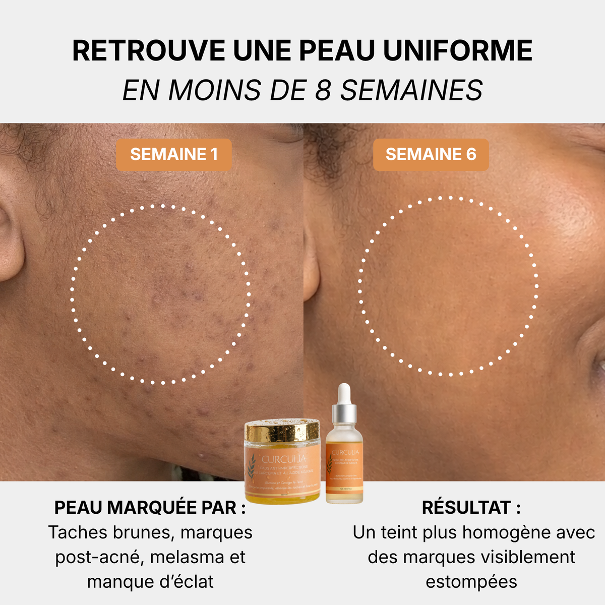 Routine Anti-Imperfections