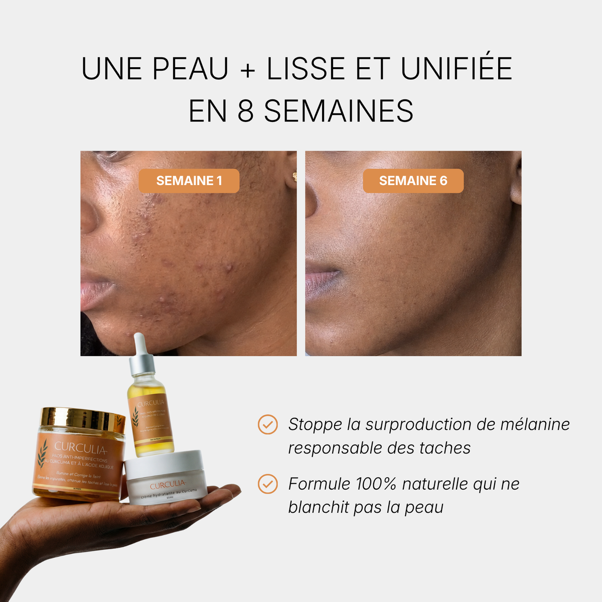 Routine Anti-Imperfections
