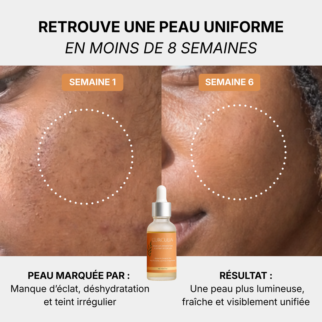 Sérum Anti-Imperfections 3 en 1