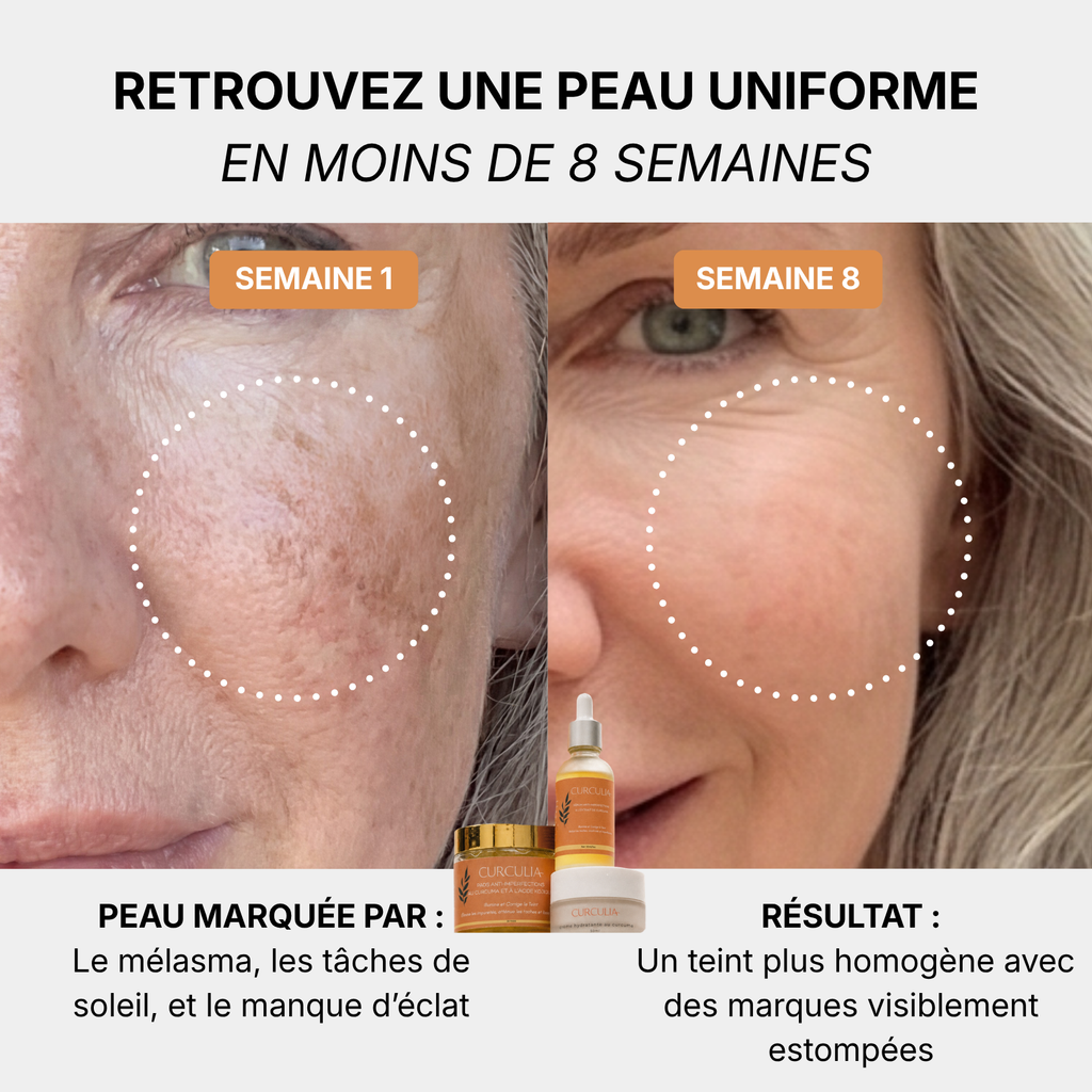 Routine Anti-Melasma