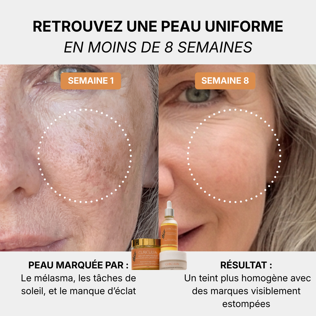 Routine Anti-Melasma