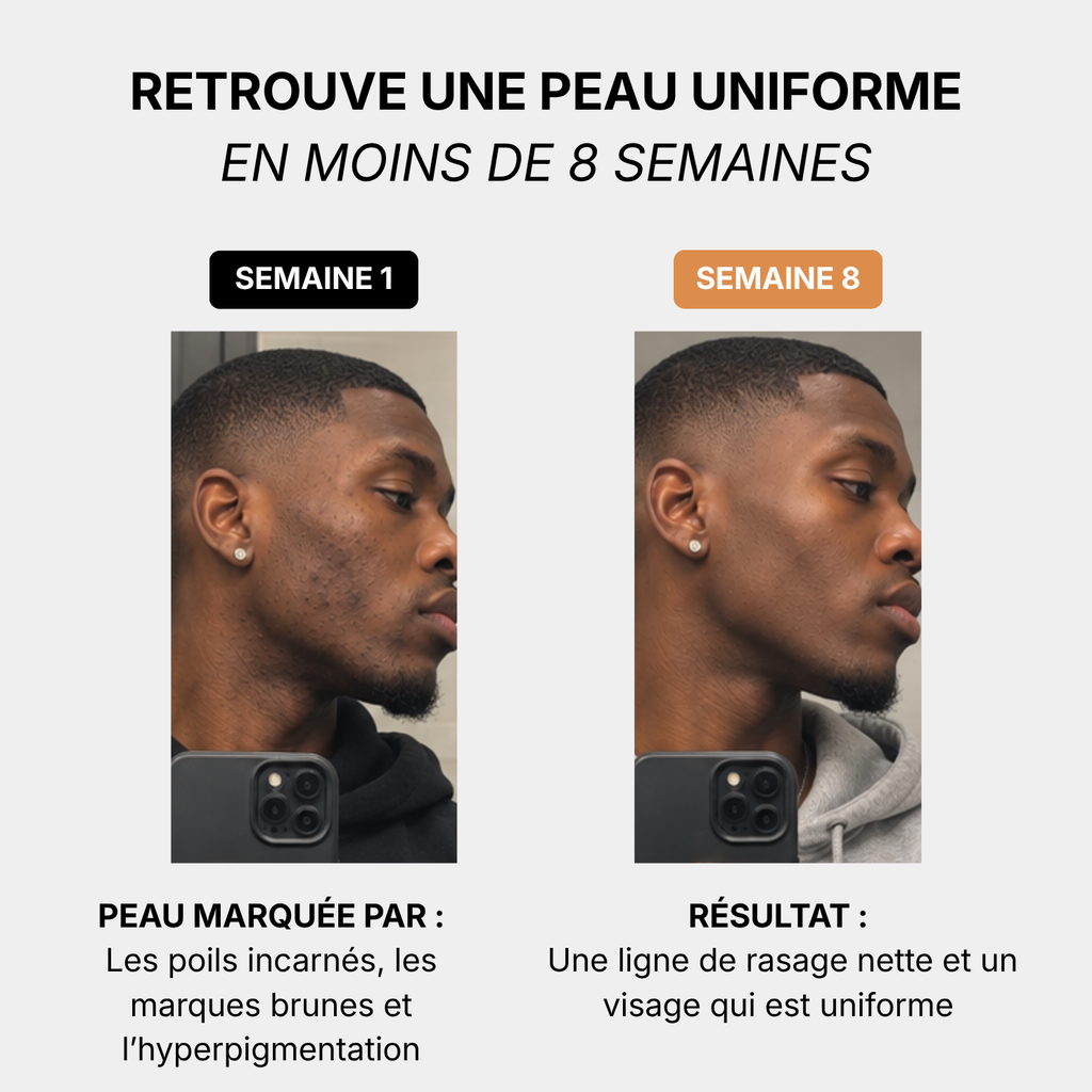 Routine Anti taches Homme