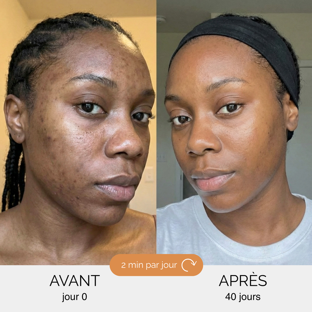 Routine Anti-Imperfections