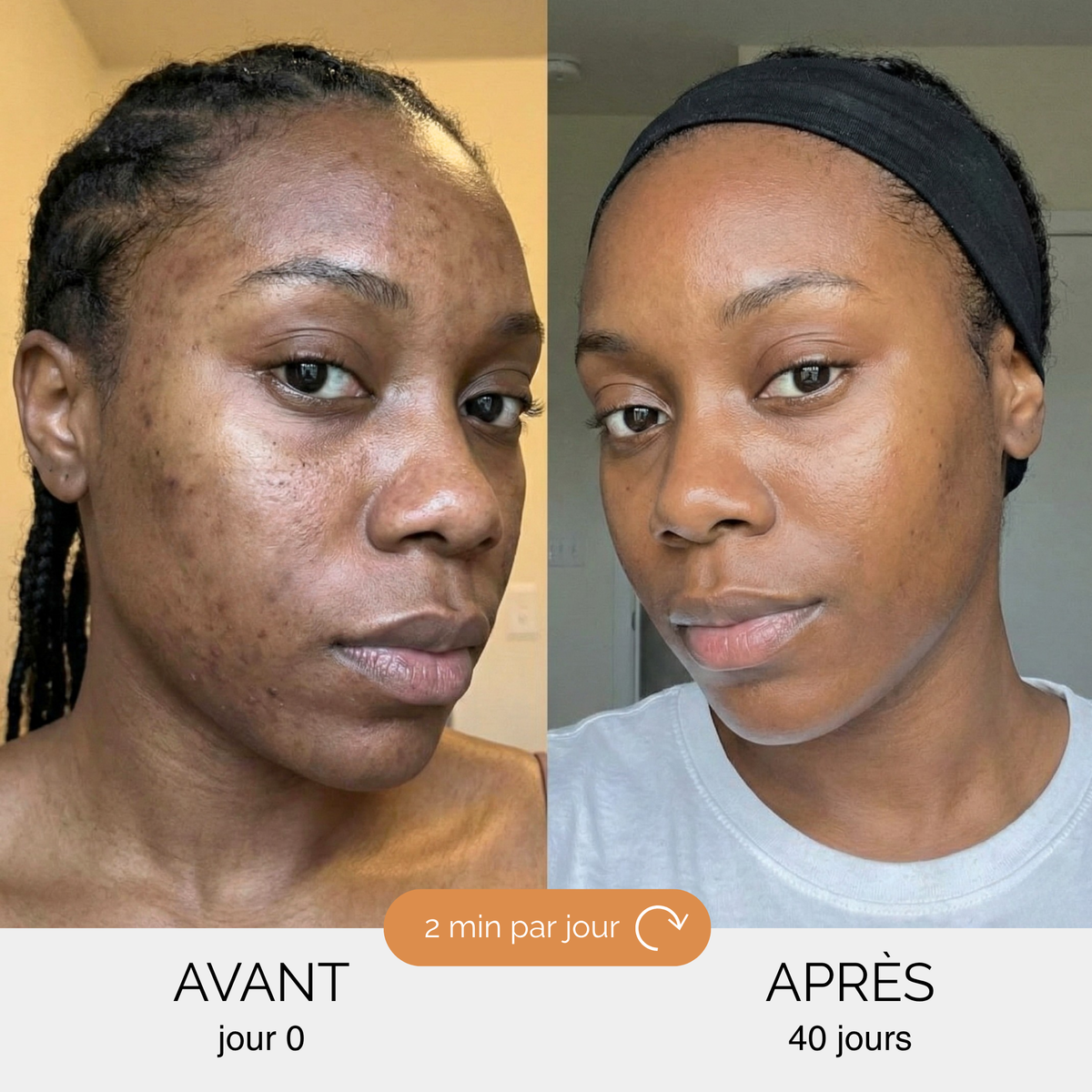 Routine Anti-Imperfections