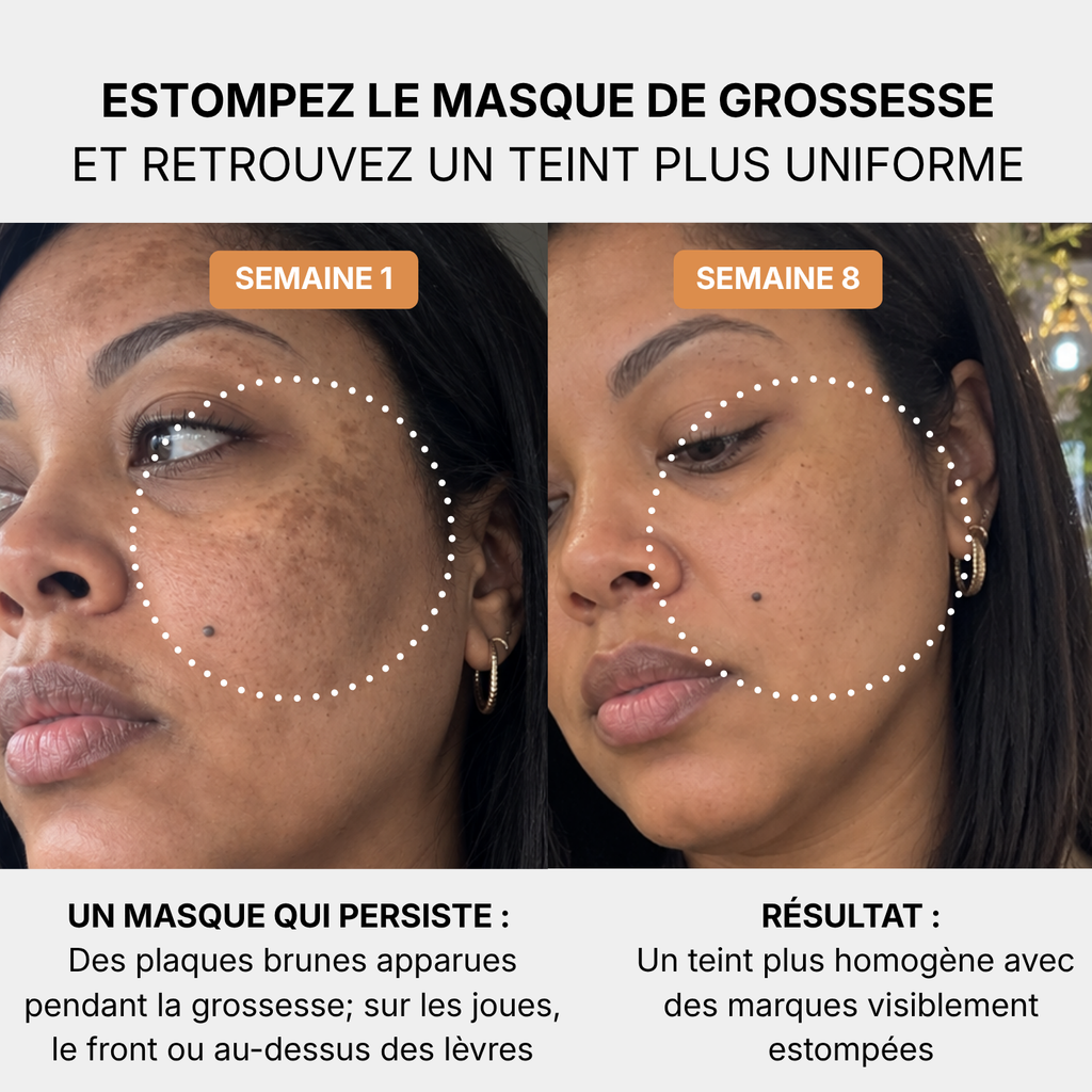 Routine Anti-Masque de Grossesse