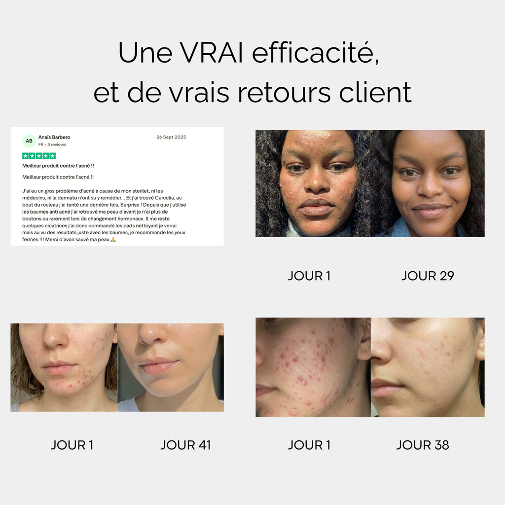 Baume de jour anti-acné