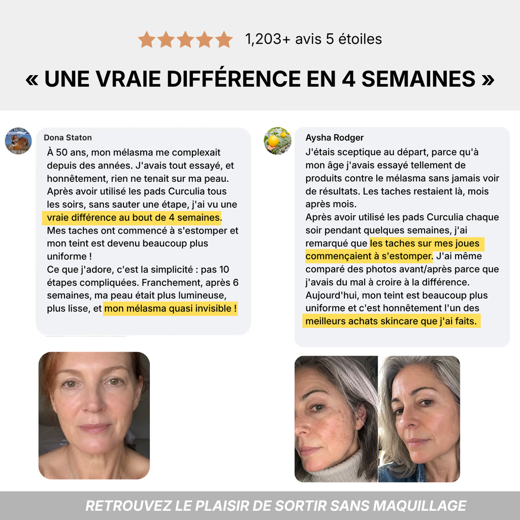 Routine Anti-Melasma