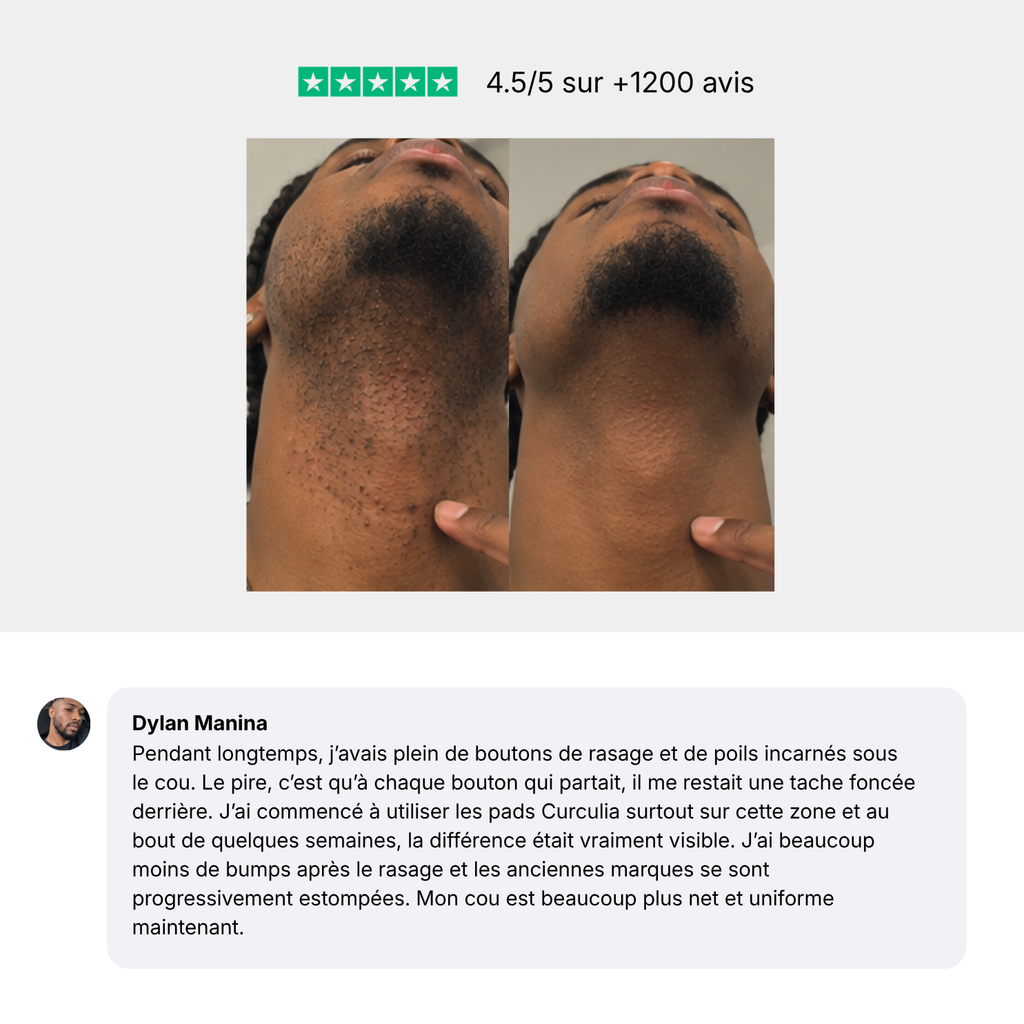 Routine Anti taches Homme