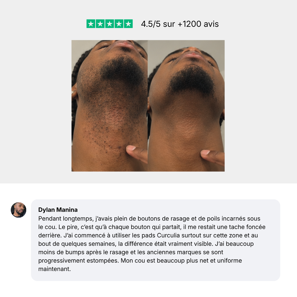 Routine Anti taches Homme