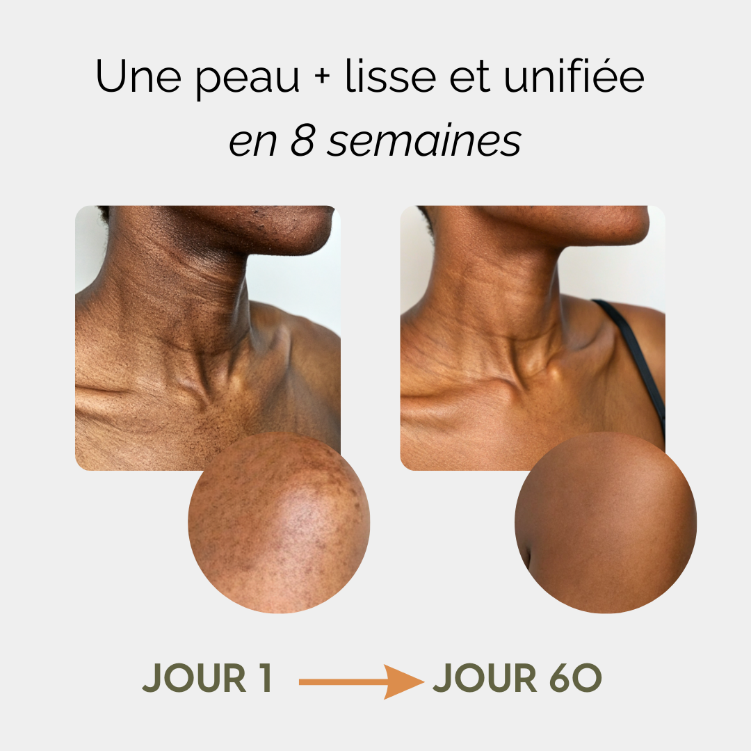 Routine Anti-Imperfections pour le Corps