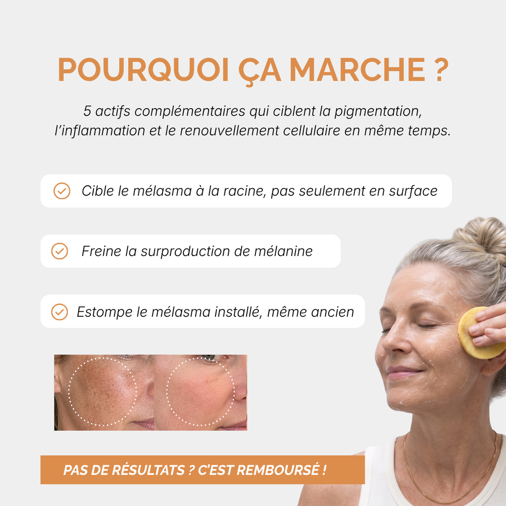 Routine Anti-Melasma