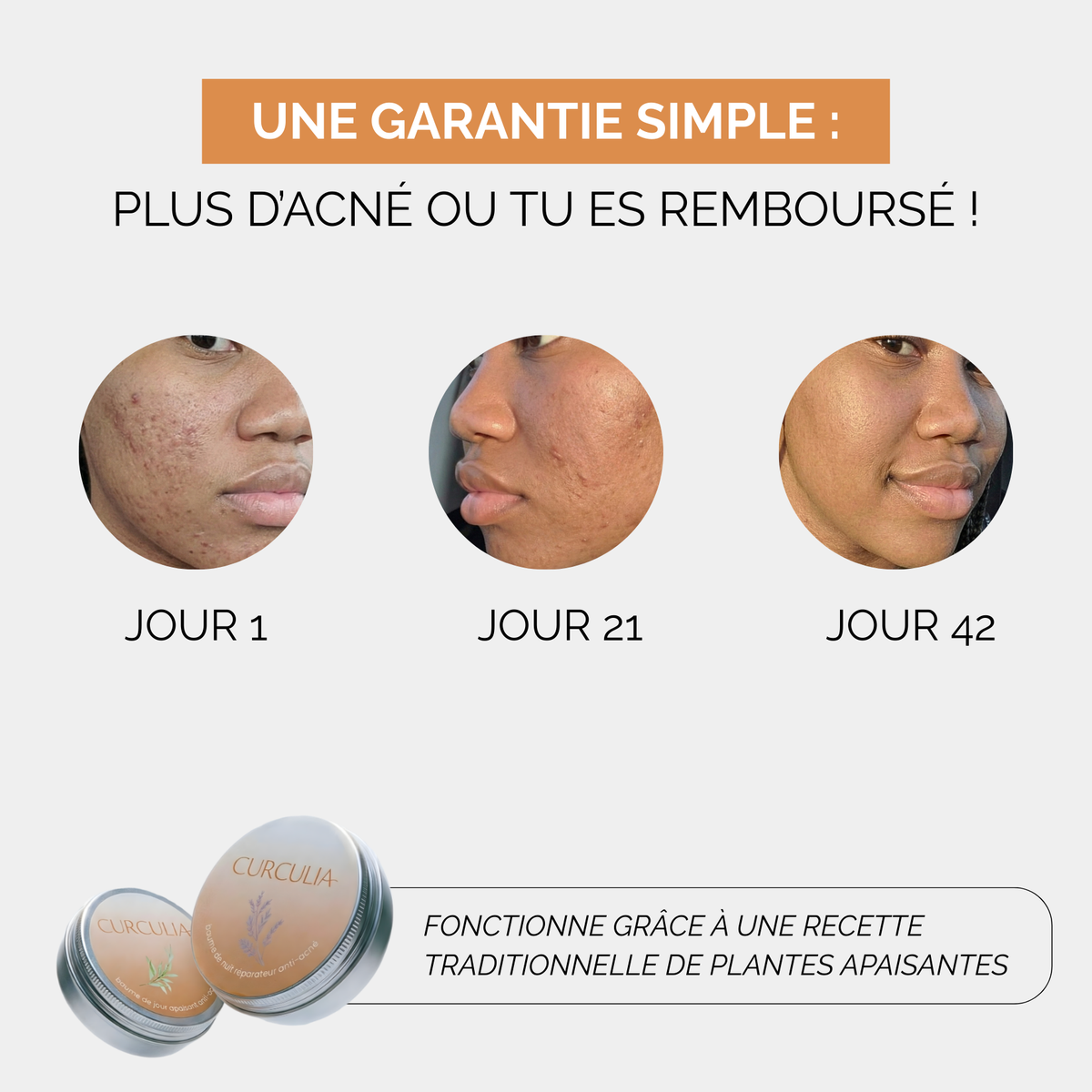 Baume de jour anti-acné