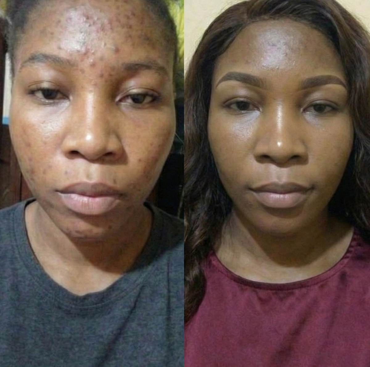 Routine Anti-Imperfections 4 en 1 – Curculia