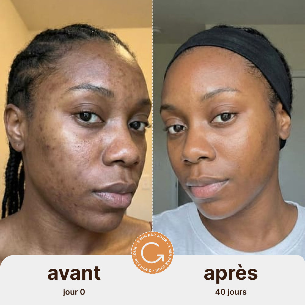 Routine Anti-Imperfections