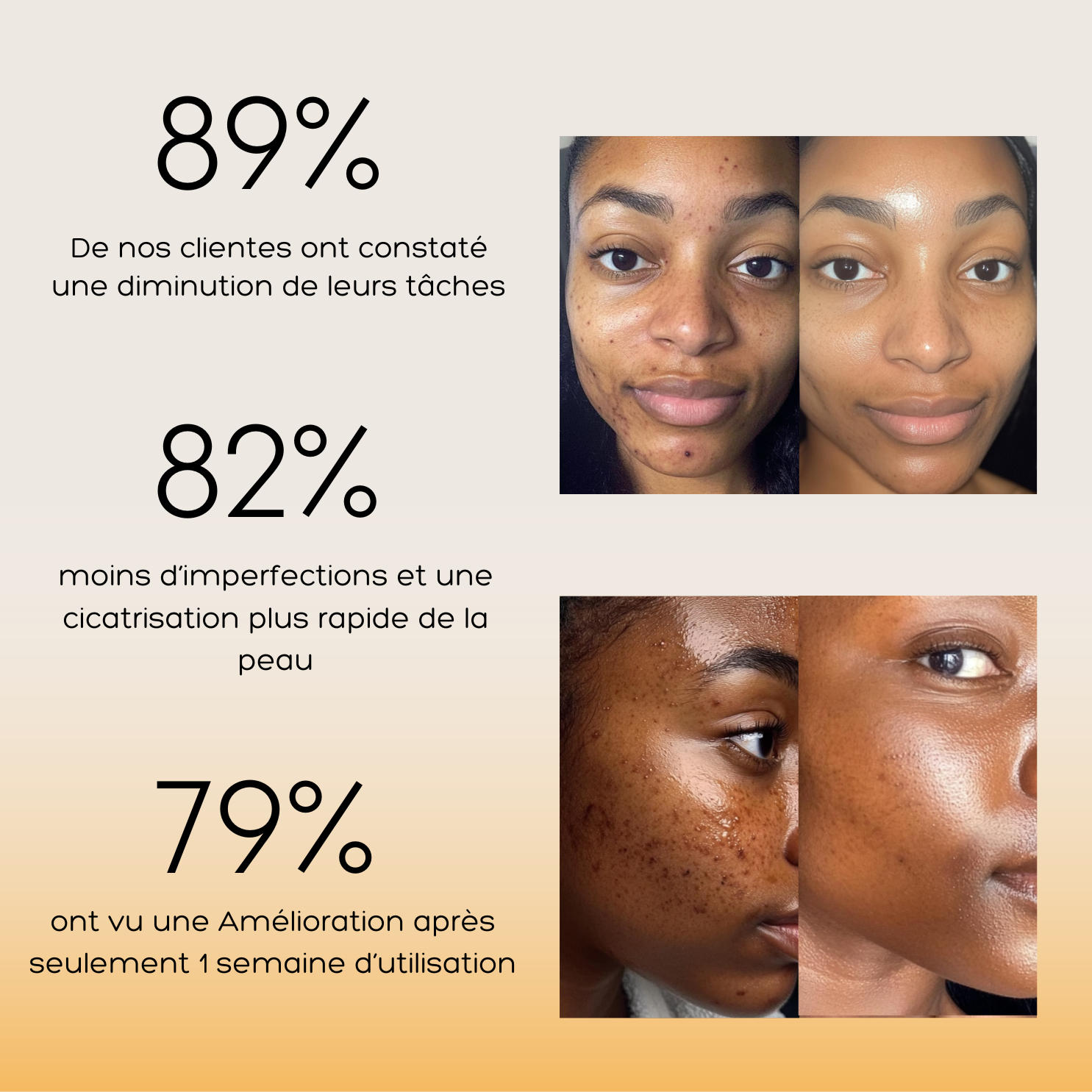 Routine Anti-Imperfections