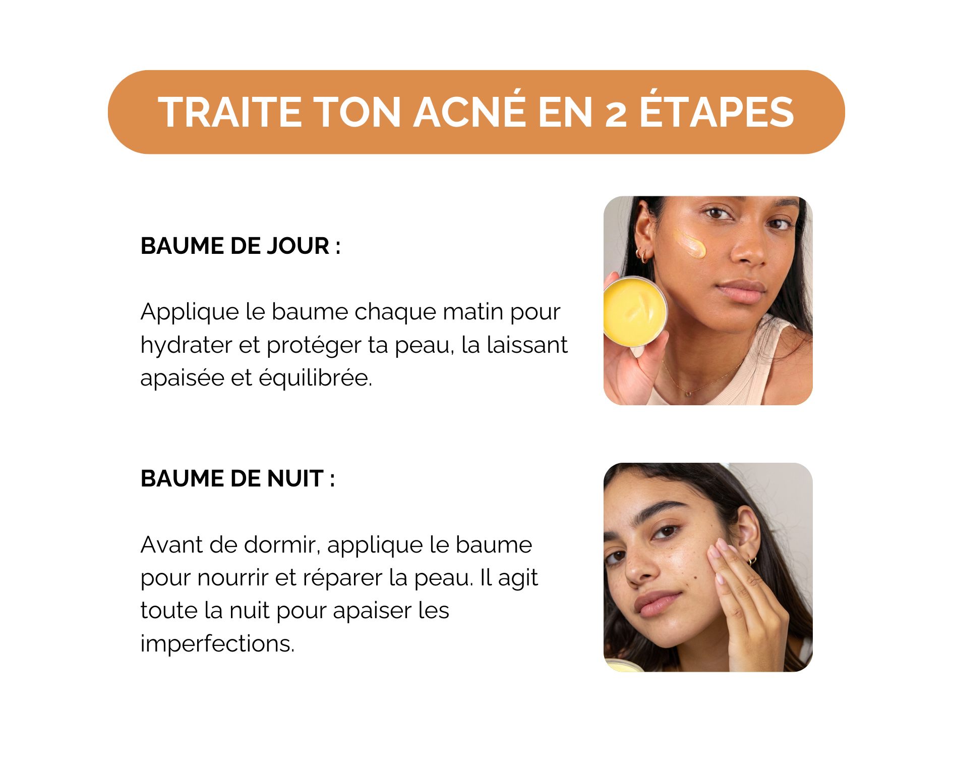 Bannière